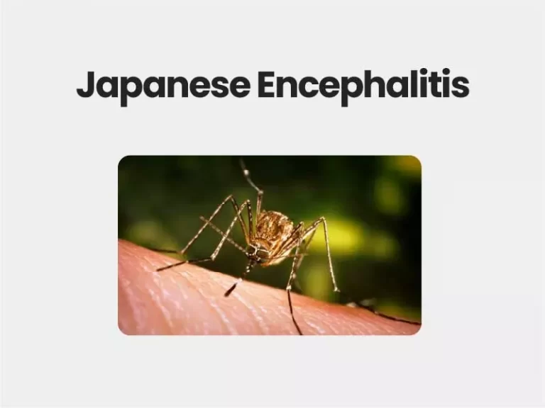 Japanese Encephalitis